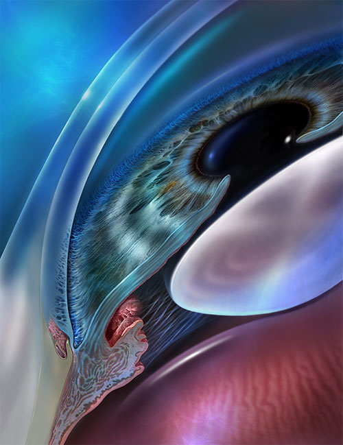 cynthia turner medical art
