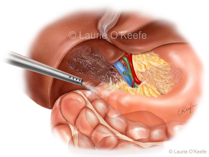 modern medical illustrators with amazing illustrations laurie o keefe